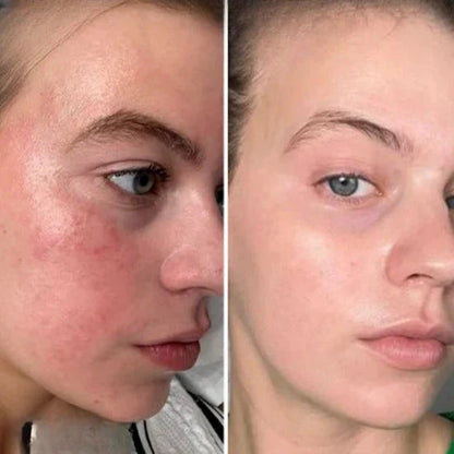 COTON DE SOIN MULTI-ACTIFS – SOIN VISAGE CORÉEN LAKERAIN